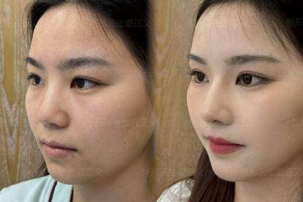 整形美人